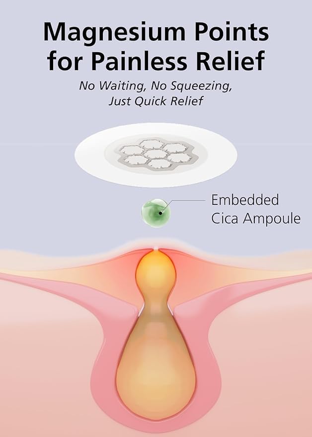 EasyDerm Micro Point Acne Patch Duo – 10 Magnesium Pimple Patches + 6 Real Calming Microdart Patches for Breakout & Post-Blemish Care, 2-Step K-Beauty Skincare Kit