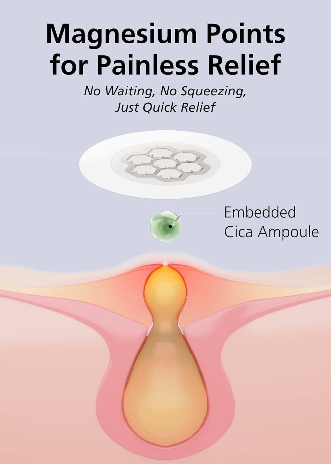 EasyDerm Quick Calming Magnesium Patches – Hydrocolloid Acne Spot Treatment Includes Tweezers & Ampoule, 10 Patches, Zit Sticker, Back to School MUST HAVE, Made by Daewoong Pharmaceutical