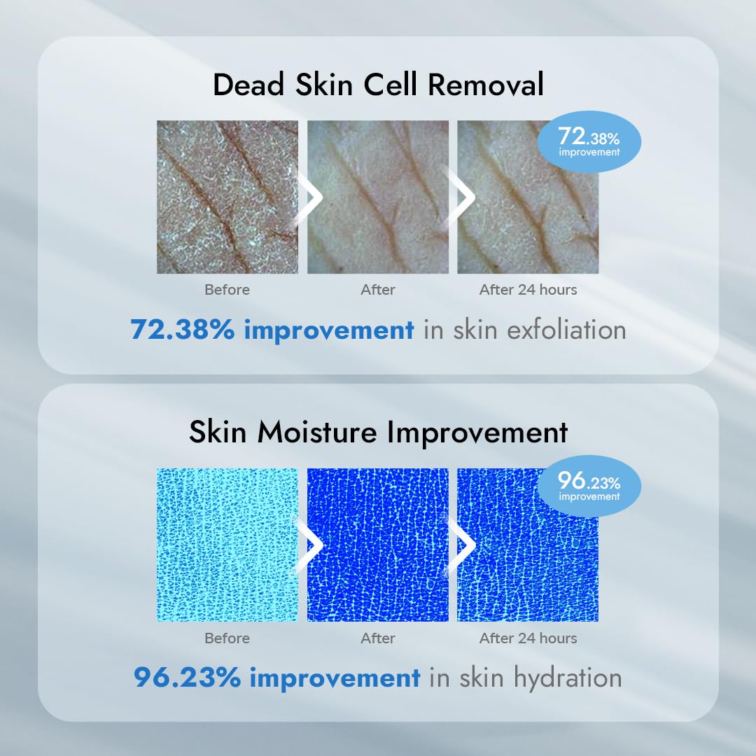 V11FACTORY AHA 12% Glycolic Acid Body Lotion – Korean Exfoliating & Hydrating Body Cream with Hyaluronic Acid & Collagen – Unscented, Paraben-Free Skin Smoothing Moisturizer, 10.6 oz