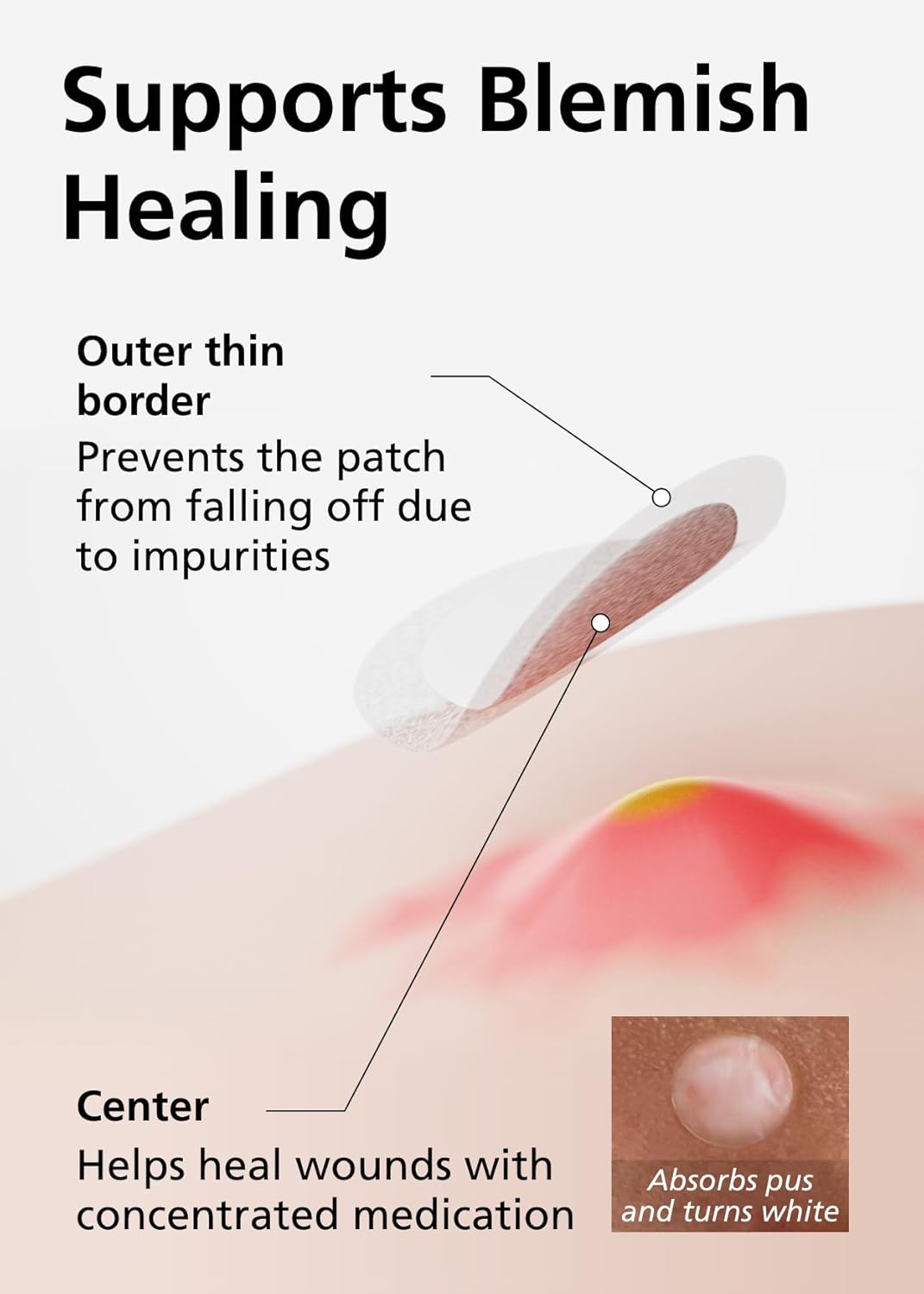 EasyDerm Beauty Patch(84 Counts) - 100% Hydrocolloid Pimple Patch for Zit Spot Care, K-beauty, Daewoong Pharmaceutical, Korean Acne Patches