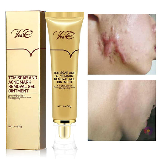 Acne Scar Removal Cream Stretch Marks Face Skin Cream Shrink Pores Gel-Fade Scar Marks Acne Skin Care (Packaging Upgrade) VeniCare