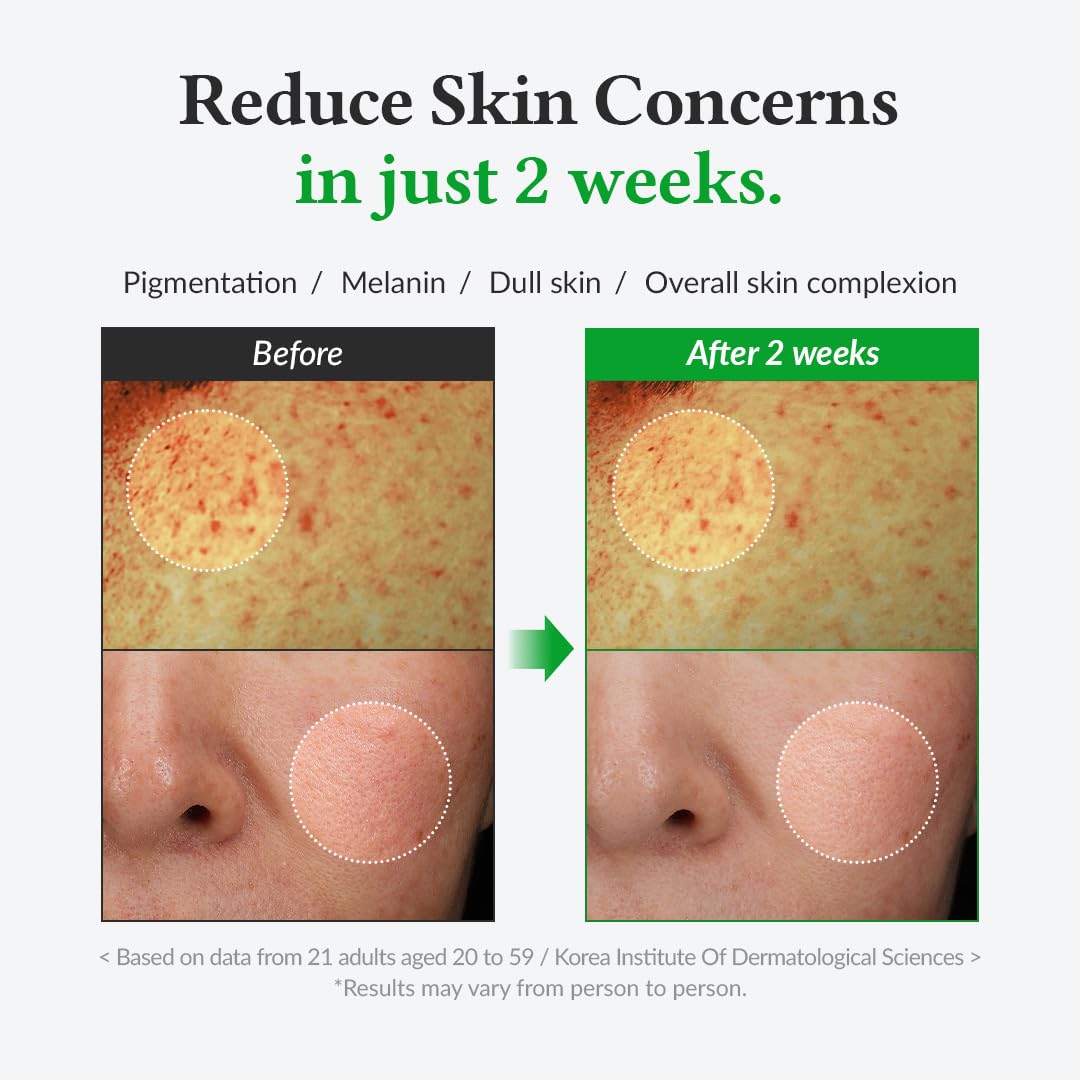 Dr.Althea Gentle Vitamin C Serum | Benefits Skin Tone and Pigmentation | Gentle on Skin For Even Skin Tone | Korean Vegan Skin Care for All Skin Types (Gentle Vitamin C)