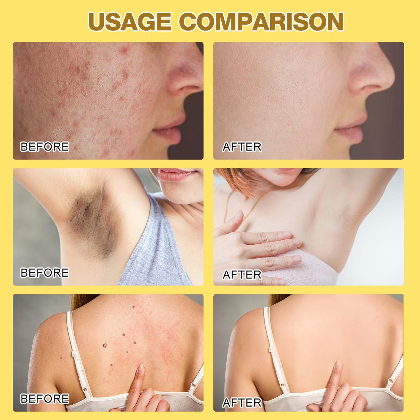 2pcs Bee Venom Treatment, New Professional Bee Venom Repair Cream, Bee Venom Cream for All Body Parts