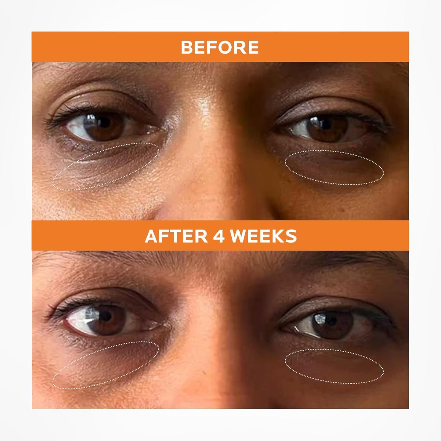 Dr. Pure Caffeine Solution 5% EGCG: Eye Contour Serum for Reduce Puffiness - Dark Circles Depuffing Solution for Tired Eyes Hydrating and Smoothing Formula with Hyaluronic Acid 2 Fl Oz