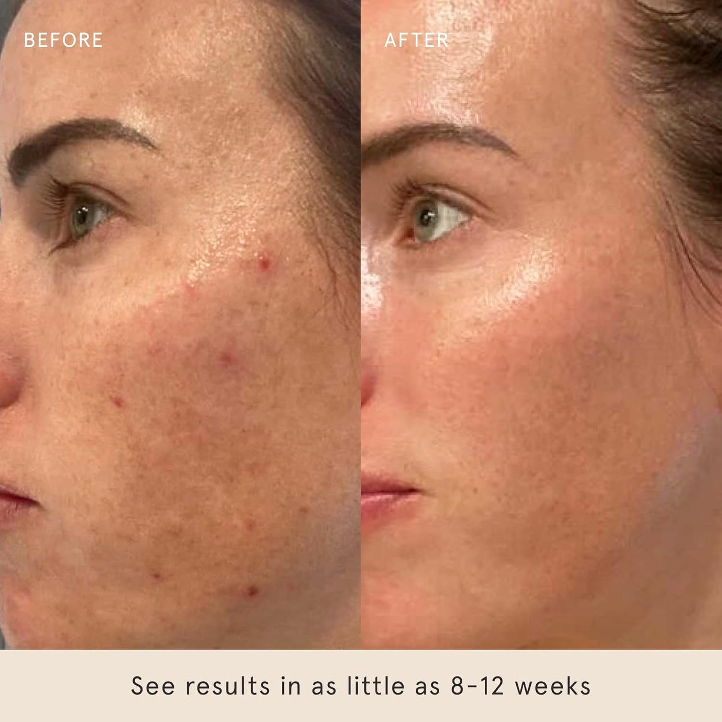 Barefaced Retinal Skin Therapy 30ml - Retinaldehyde & Bakuchiol Serum for Firming, Reducing Fine Lines & Wrinkles, Improving Skin Tone & Texture w/ Shea Butter, Jojoba Oil & Argan Oil