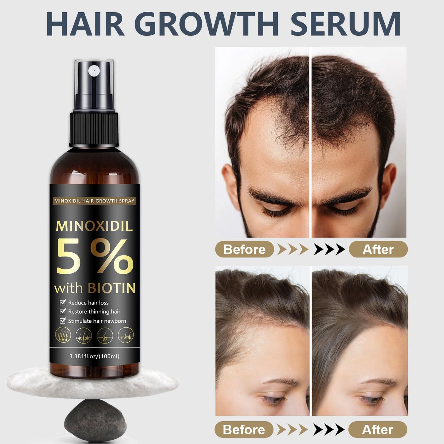 5% Minoxidil Hair & Beard Growth Spray with Biotin for Men & Women, Hair Regrowth, Treatment for Hair Loss & Thinning, for Stronger Thicker Fuller Healthier Hair, for All Hair Types, 3.38 oz