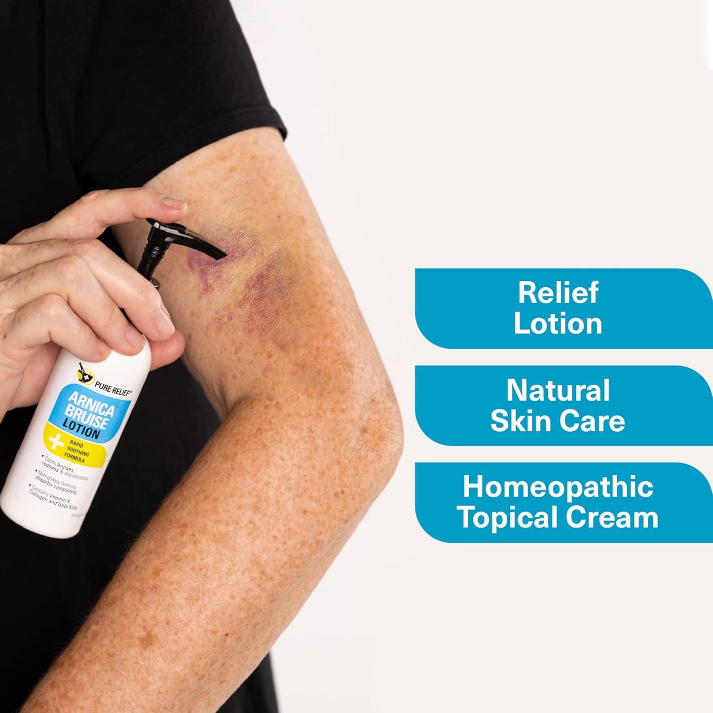 Arnica Cream Bruise Relief Lotion for Bruising and Swelling On Skin | Bruise Cream Extra Strength Vitamin K Cream | Moisturizing Arnica Bruise Formula Skin Care Gel W/Collagen, 4 Fl Oz