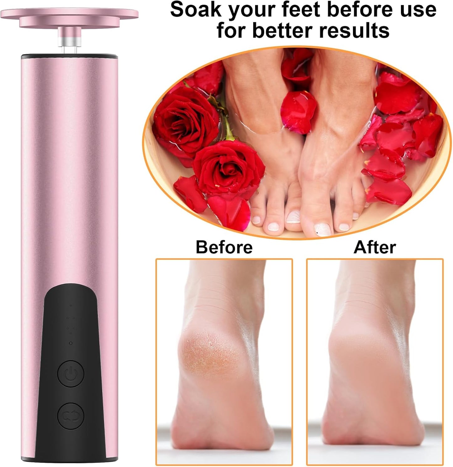 ele ELEOPTION Electric Callus Remover for Feet Electric Foot File Nail Grinder 6 Speed Adjustable Rechargeable Professional Foot Sander Pedicure Tool for Feet Dry Dead Skin Pink