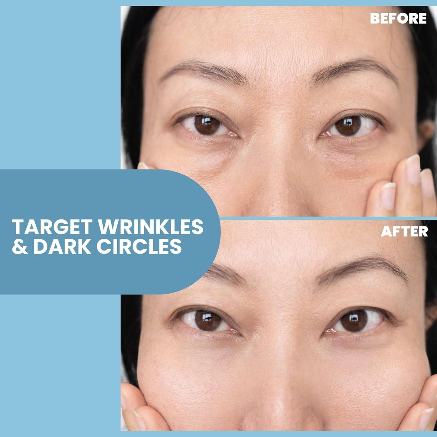 Eva Naturals Eye Gel for Dark Circles, Bags & Puffiness – Anti-Aging Serum with Peptides, Hyaluronic Acid & Botanicals – Firming Under Eye Treatment for Wrinkles, Fine Lines & Tired Skin – 2 oz 2 Pack