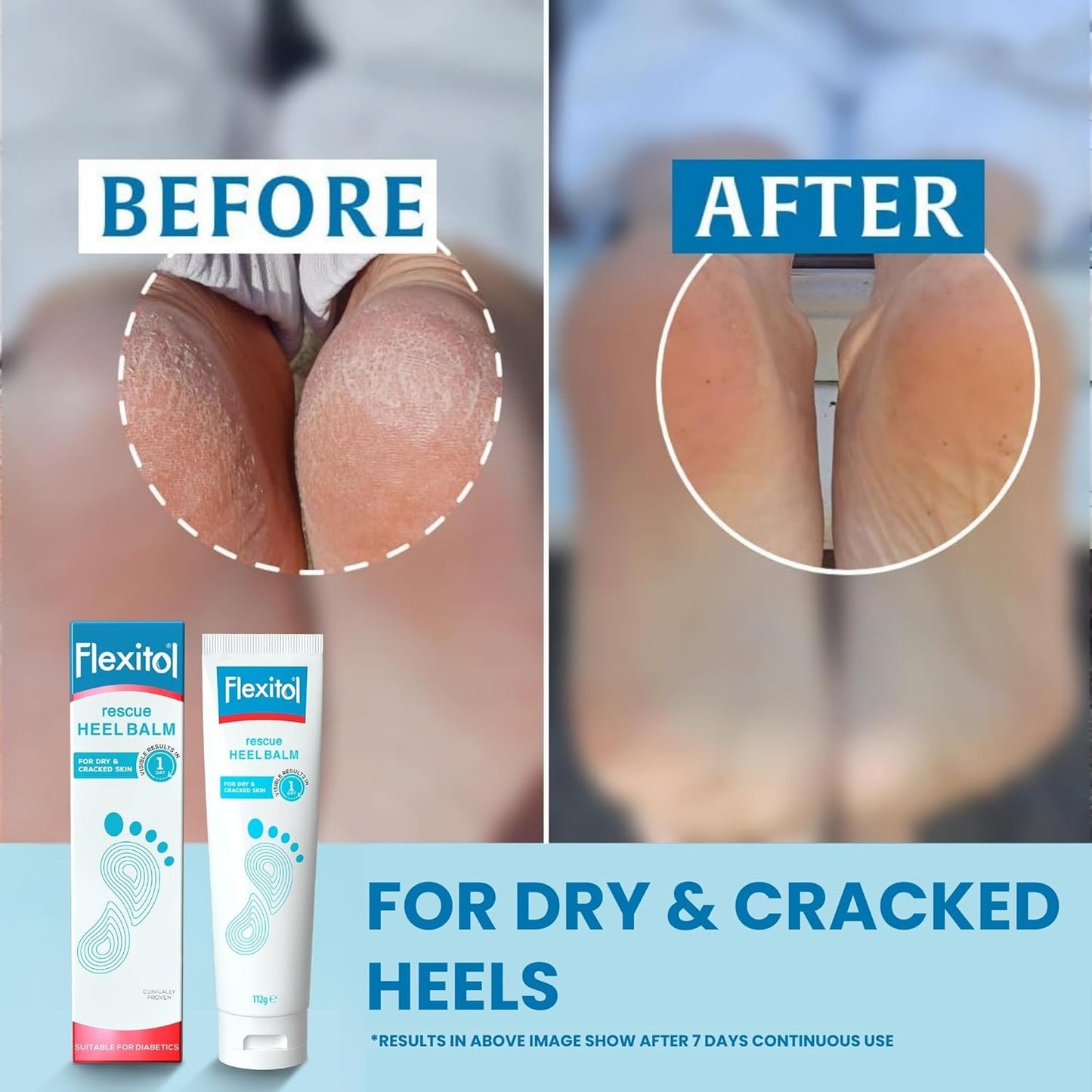 Flexitol Heel Balm, Rich Moisturizing & Exfoliating Foot Cream, Original Version, 4 Oz