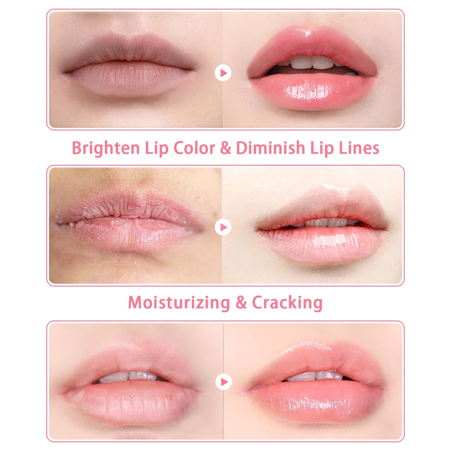 3 PCS Bee Lip Balm Lip Mask Honey Pot, Watermelon & Cherry & Coconut Lip Mask Propolis Moisturizing Lip, Hydrating Prevention Dry and Cracked Lip Scrubs Exfoliator (Watermelon & Cherry & Coconut)