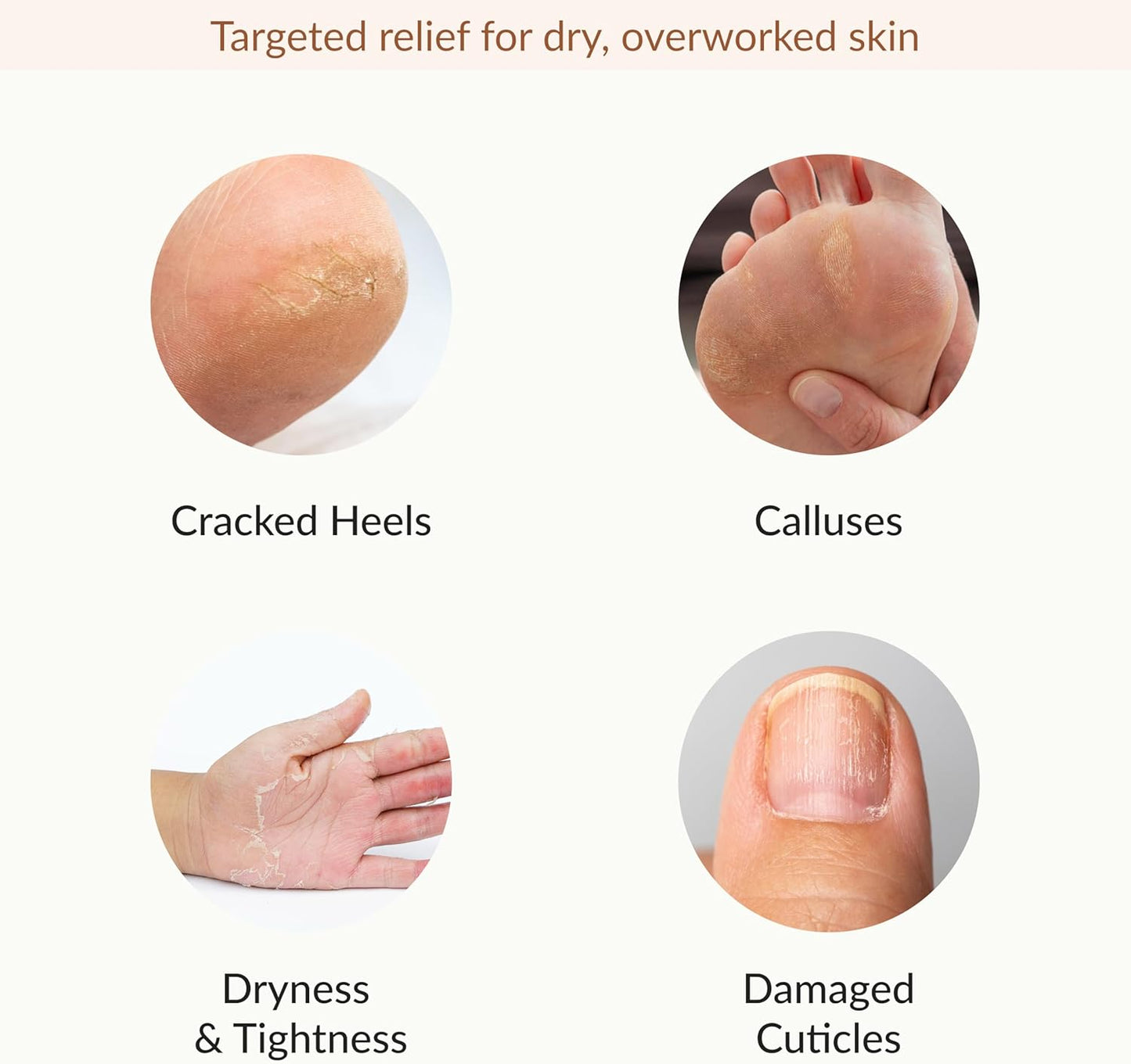 Epielle Hydrating & Moisturizing Hand & Foot Masks 12 Pairs, Relieve and Soften Dry Hands & Cracked Heels with Shea Butter & Sunflower Seed Oil, Korean Skin Care, Spa Set, Self Care Gifts for Women