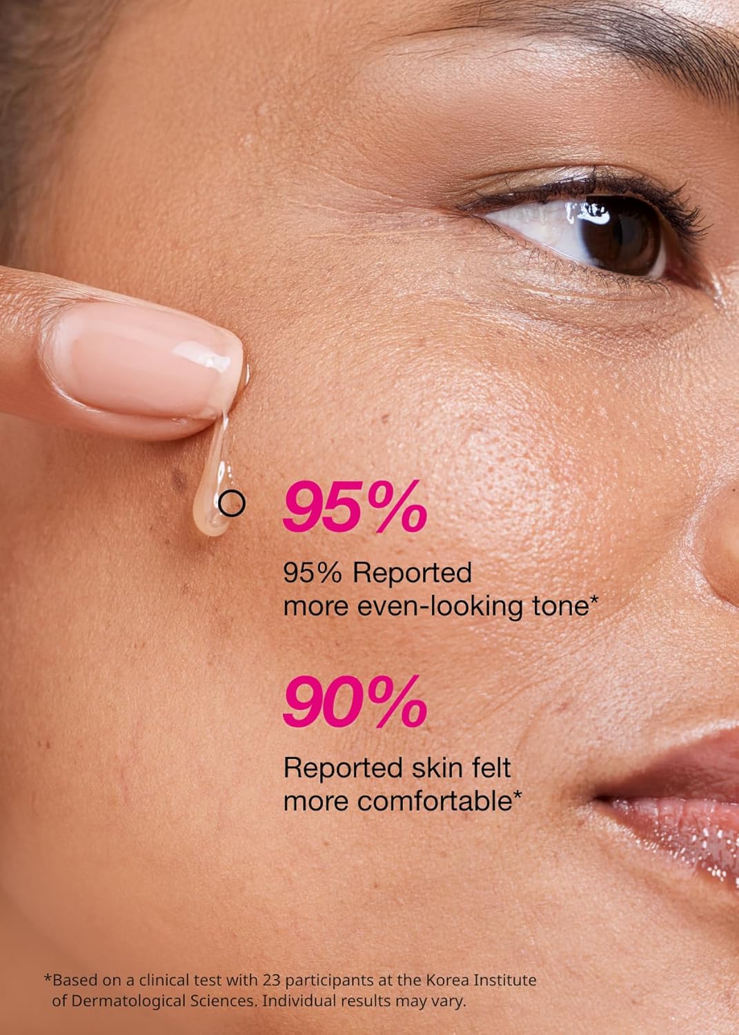 ISOI Blemish Care Up Serum for Face, Vegan Hydrating Serum for Smooth & Glass Skin Effect, Skin Barrier & Moisture Balance for Women, Arbutin, Korean Skin Care (0.85 fl. oz, 25ml)