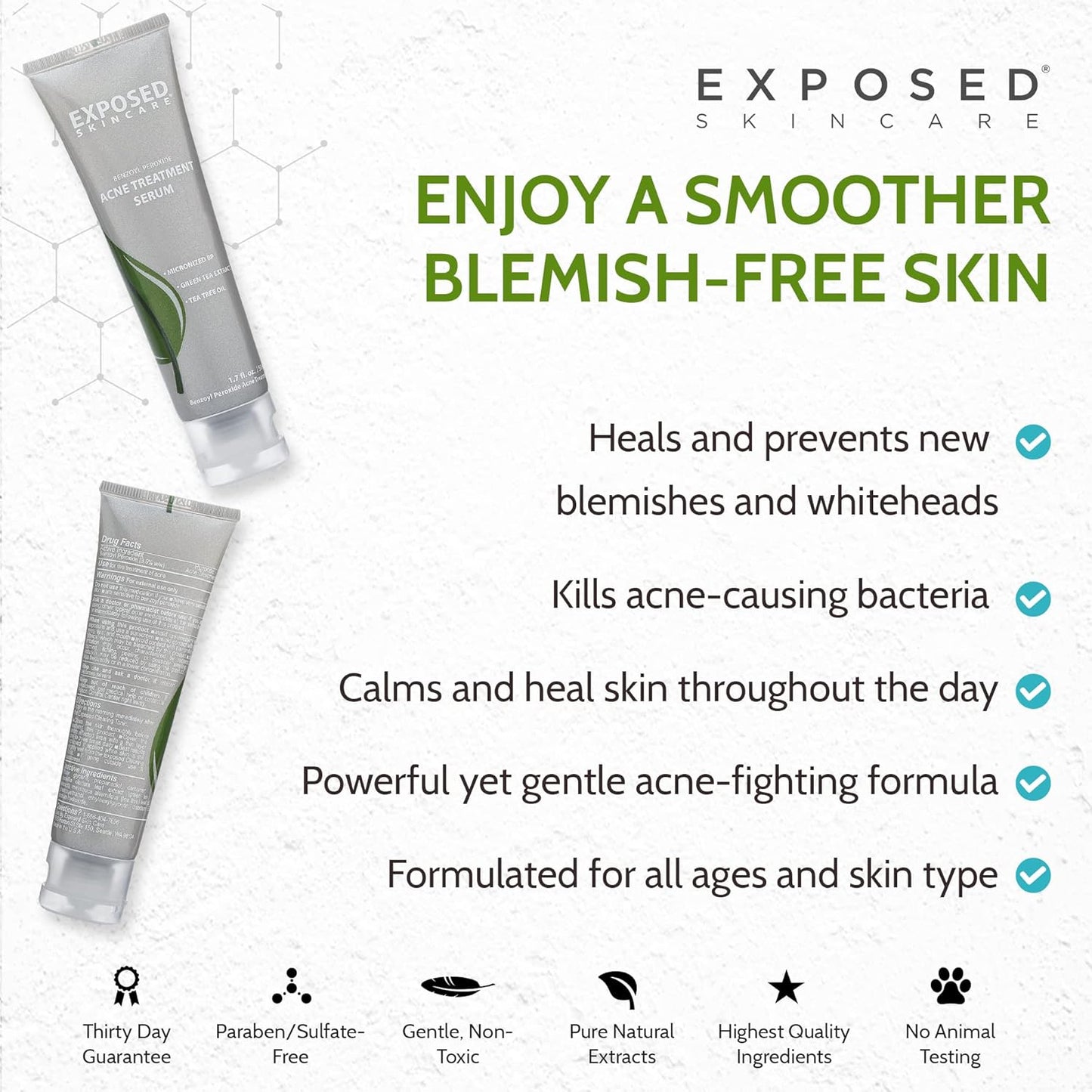 Exposed Skin Care Acne Treatment Serum Step 3 – Quickly Reduces Pimple Size and Redness - 12 Hour Spot Treatment - 3.5% Benzoyl Peroxide, Natural Green Tea & Tea Tree Oil