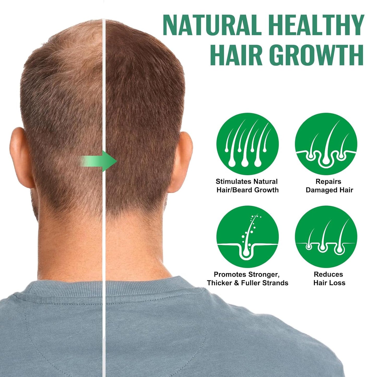 Hair Growth Serum Spray, Natural Hair Growth Spray With Biotin, Batana, Rosemary, and Castor Oil, Caffeine Ginseng Scalp Care Treatment, Thinning Hair Regrowth Thickening for Women Men 4 Fl Oz