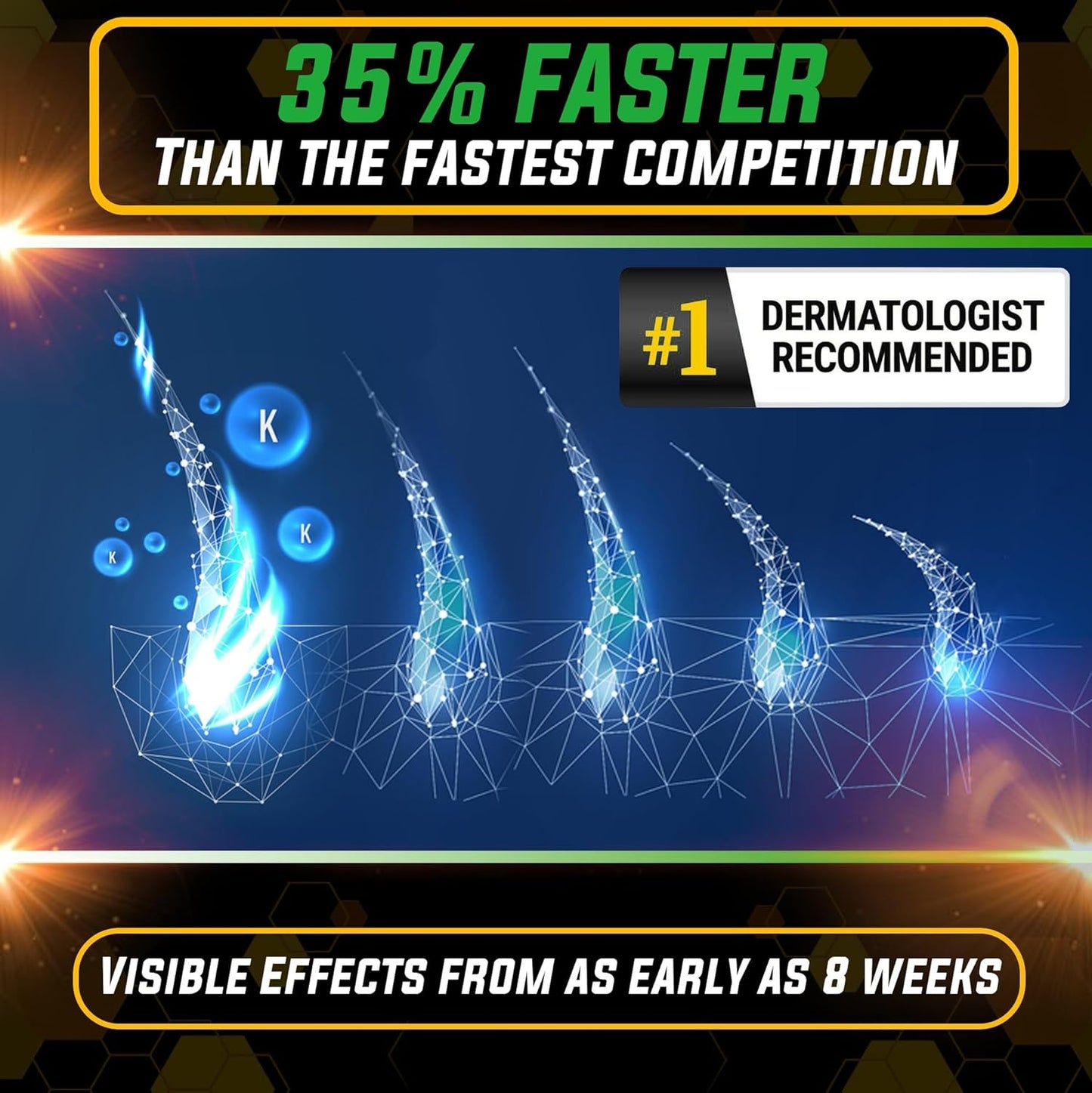 Elevate Hair Regrowth Treatment 5% Minoxidil Spray - Extra Strength Formula Professional Treatment for Hair Loss and Thinning for Regrowth - Stimulate Follicles for Men and Women 1 Month Supply