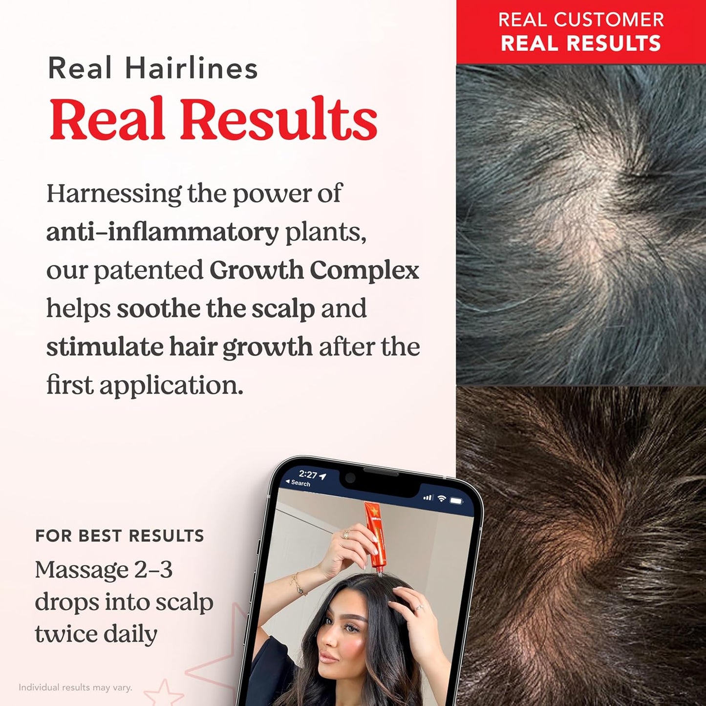 HAIRtamin Scalp Serum | Visibly Thicker, Nourished Hair and Healthy Scalp Treatment (Two Pack)