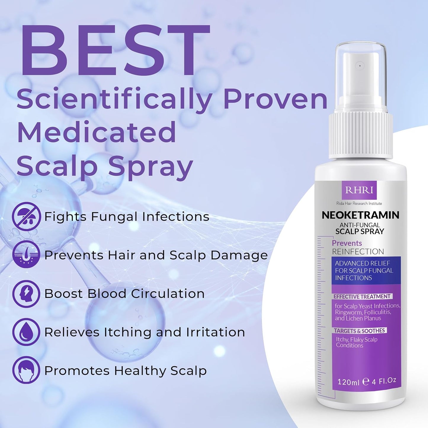 Neoketramin Anti Fungal Scalp Spray | Dandruff Treatment for Dandruff, Psoriasis & Folliculitis | Antifungal & Itchy Scalp Treatment for Dry, Irritated Scalp | Relief for Yeast Infections & Ringworm