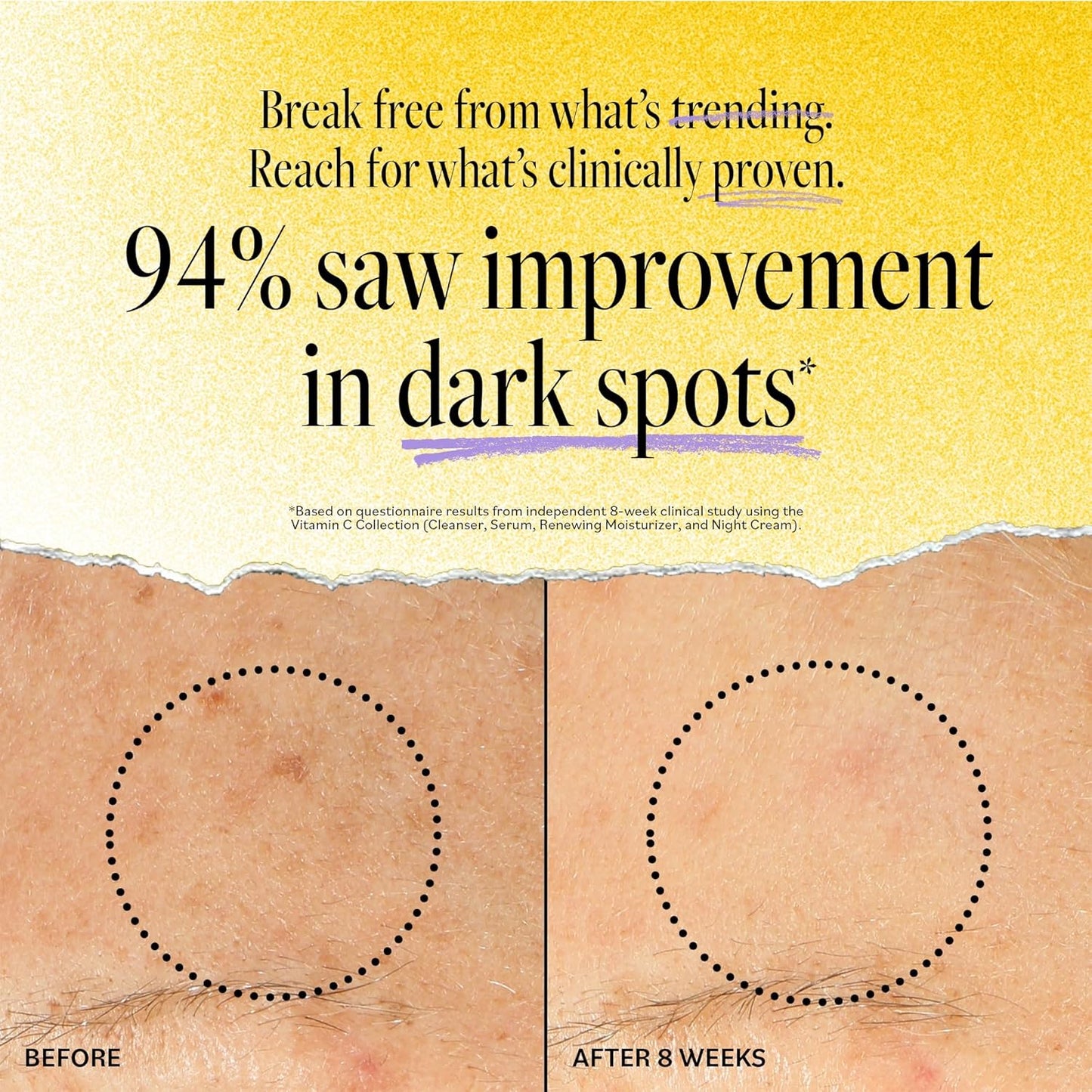 DERMA-E Vitamin C Intense Night Cream – Brightening and Hydrating Facial Skin Renewing Cream – Anti-Aging Overnight Facial Moisturizer, 2 oz